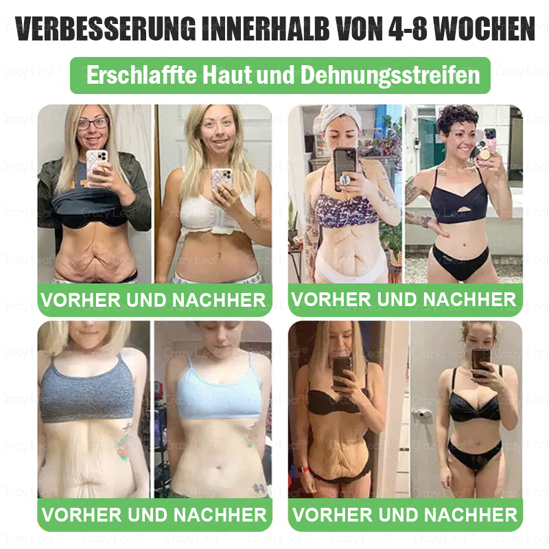 DE Klinisch bewiesen | Offizieller Shop | 𝐂𝒓𝓪𝙯𝙮𝐋𝑒𝑎𝐟® 𝚂𝖬𝐺𝘛-𝘎𝐿𝙋-1 Orallösung gegen Übergewicht, Bluthochdruck, Blutzucker- & Fettleberprobleme, Gelenkschmerzen, Müdigkeit, Energiemangel & schlaffe Haut – für mehr Gesundheit & Vitalität.
