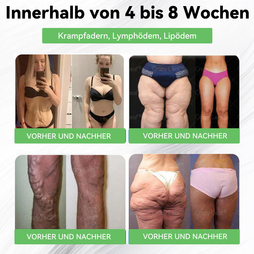 DE Klinisch bewiesen | Offizieller Shop | 𝐂𝒓𝓪𝙯𝙮𝐋𝑒𝑎𝐟® 𝚂𝖬𝐺𝘛-𝘎𝐿𝙋-1 Orallösung gegen Übergewicht, Bluthochdruck, Blutzucker- & Fettleberprobleme, Gelenkschmerzen, Müdigkeit, Energiemangel & schlaffe Haut – für mehr Gesundheit & Vitalität.