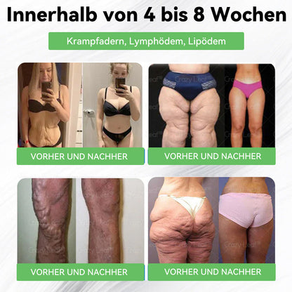 DE Klinisch bewiesen | Offizieller Shop | 𝐂𝒓𝓪𝙯𝙮𝐋𝑒𝑎𝐟® 𝚂𝖬𝐺𝘛-𝘎𝐿𝙋-1 Orallösung gegen Übergewicht, Bluthochdruck, Blutzucker- & Fettleberprobleme, Gelenkschmerzen, Müdigkeit, Energiemangel & schlaffe Haut – für mehr Gesundheit & Vitalität.